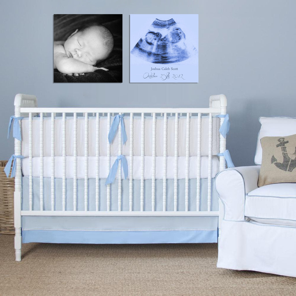 Custom Ultrasound Canvas