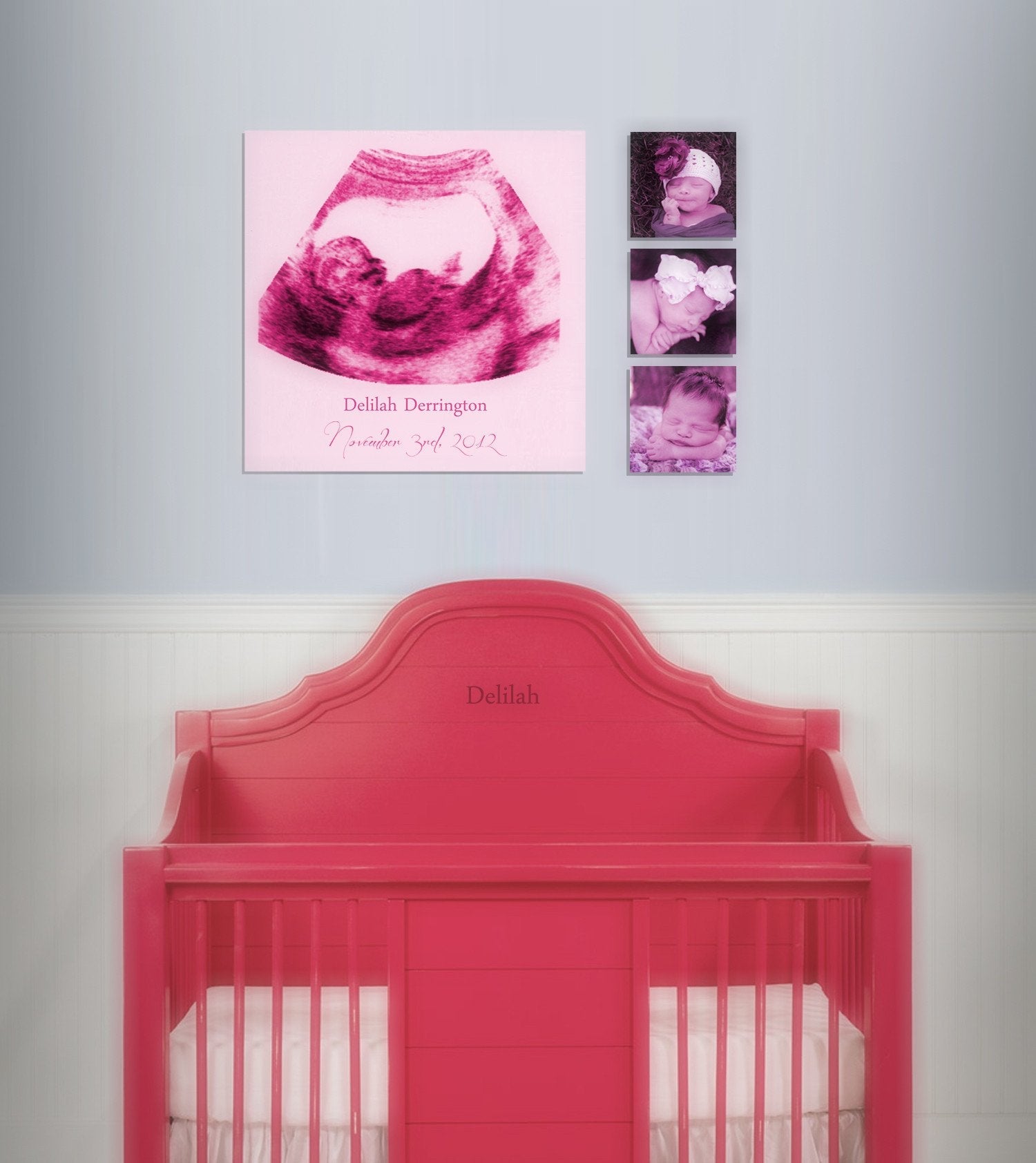 Custom Ultrasound Canvas